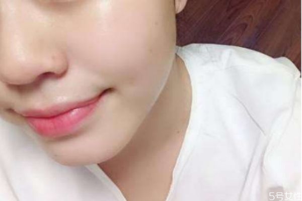 皮膚粗糙毛孔大是什么原因 皮膚毛孔粗糙怎么辦 皮膚粗糙毛孔大是什么原因 皮膚毛孔粗糙怎么辦