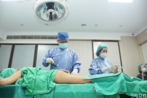 腿部抽脂多久能恢復(fù) 腿部抽脂恢復(fù)時(shí)間 腿部抽脂多久能恢復(fù) 腿部抽脂恢復(fù)時(shí)間