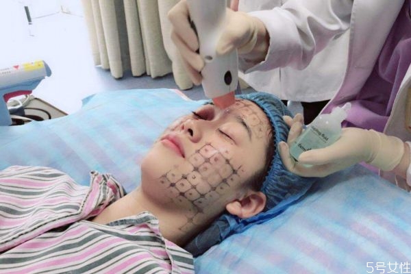 熱瑪吉怎樣是什么 熱瑪吉適應(yīng)人群