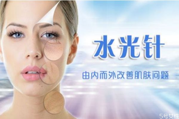 水光針能維持多長(zhǎng)時(shí)間 多久打一次水光針效果最好 水光針能維持多長(zhǎng)時(shí)間 多久打一次水光針效果最好