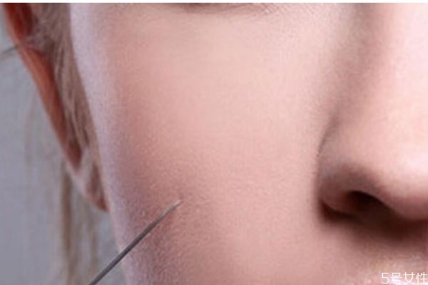 什么是水光針 正規(guī)的水光針多少錢 什么是水光針 正規(guī)的水光針多少錢