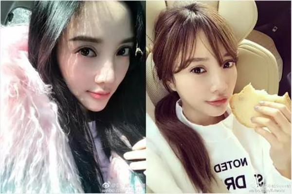 壓雙眼皮價(jià)格受什么影響 壓雙眼皮術(shù)后要注意什么 壓雙眼皮價(jià)格受什么影響 壓雙眼皮術(shù)后要注意什么