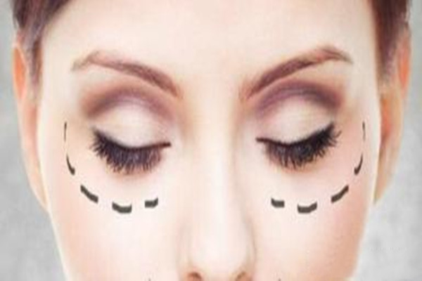 眼袋的壞處 超聲波去眼袋會(huì)打麻藥嗎 眼袋的壞處 超聲波去眼袋會(huì)打麻藥嗎