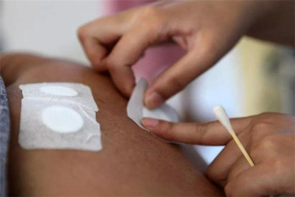 三伏貼安全嗎 三伏貼為什么不能貼的時(shí)間太長(zhǎng) 三伏貼安全嗎 三伏貼為什么不能貼的時(shí)間太長(zhǎng)