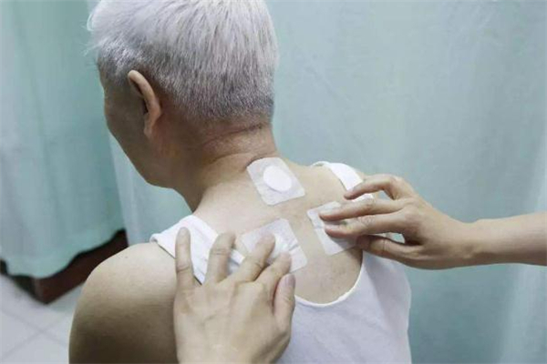 三伏貼一年四季都能貼嗎 三伏貼為什么貼了感覺涼 三伏貼一年四季都能貼嗎 三伏貼為什么貼了感覺涼