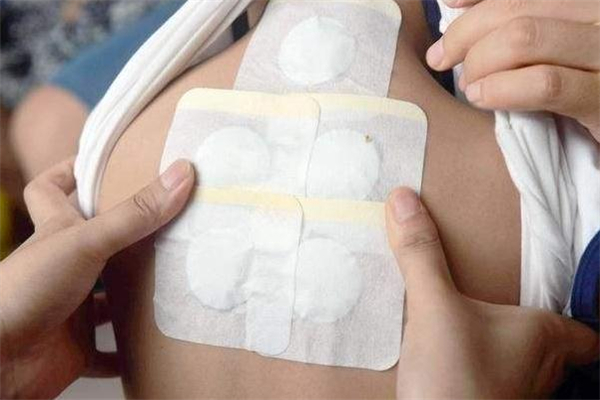 兒童三伏貼效果怎么樣 兒童三伏貼和大人的一樣嗎 兒童三伏貼效果怎么樣 兒童三伏貼和大人的一樣嗎