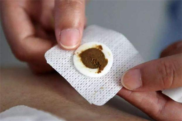 三伏貼為什么會發(fā)熱 三伏貼能治老寒腿嗎 三伏貼為什么會發(fā)熱 三伏貼能治老寒腿嗎