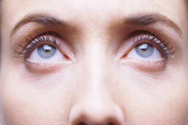 眼袋出現(xiàn)的原因 韓式去眼袋有效果嗎 眼袋出現(xiàn)的原因 韓式去眼袋有效果嗎