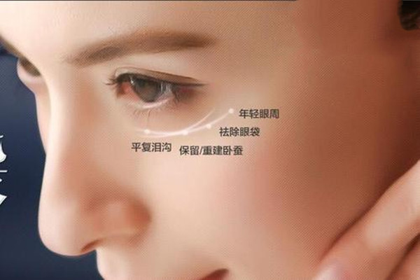 韓式去眼袋適合什么人 韓式去眼袋的手術(shù)怎么做 韓式去眼袋適合什么人 韓式去眼袋的手術(shù)怎么做