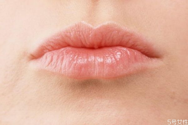 嘴角皮膚發(fā)黑是什么原因 怎樣快速去除嘴角黑印 嘴角皮膚發(fā)黑是什么原因 怎樣快速去除嘴角黑印