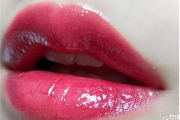 嘴角皮膚發(fā)黑是什么原因 怎樣快速去除嘴角黑印 嘴角皮膚發(fā)黑是什么原因 怎樣快速去除嘴角黑印