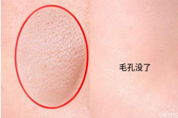 有什么護(hù)理收縮毛孔的方法 最簡單的收縮毛孔方法 有什么護(hù)理收縮毛孔的方法 最簡單的收縮毛孔方法