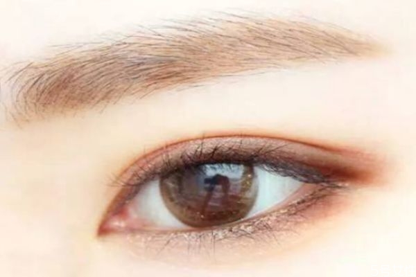 美瞳線適合哪些人群 做美瞳線禁忌人群 美瞳線適合哪些人群 做美瞳線禁忌人群