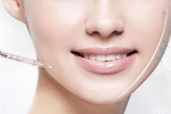 瘦臉針多久打一次好 瘦臉針第一針和第二針間隔 瘦臉針多久打一次好 瘦臉針第一針和第二針間隔