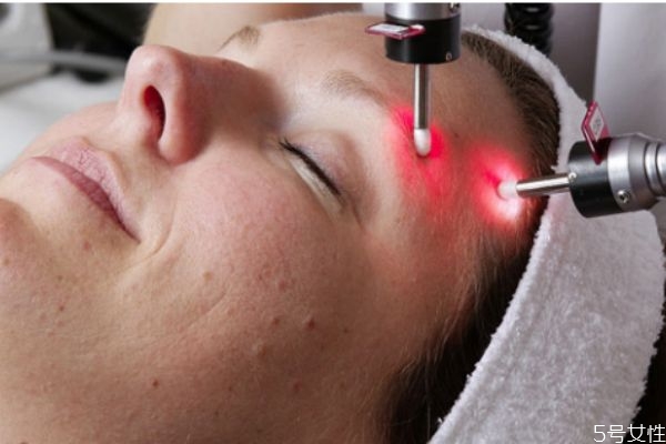 怎么去臉上的痘坑 臉上的痘坑痘印怎么修復 怎么去臉上的痘坑 臉上的痘坑痘印怎么修復