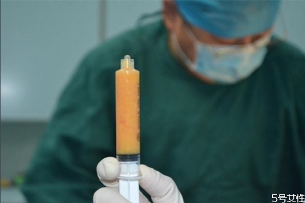 哪些部位可以做吸脂手術(shù) 哪些部位不能抽脂 哪些部位可以做吸脂手術(shù) 哪些部位不能抽脂