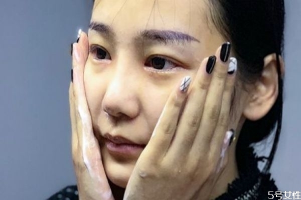 青春期皮膚變差怎么辦 青春期應(yīng)該怎么護膚 青春期皮膚變差怎么辦 青春期應(yīng)該怎么護膚