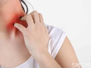 蕁麻疹檢查需要空腹嗎 蕁麻疹發(fā)出來是排毒嗎 蕁麻疹檢查需要空腹嗎 蕁麻疹發(fā)出來是排毒嗎