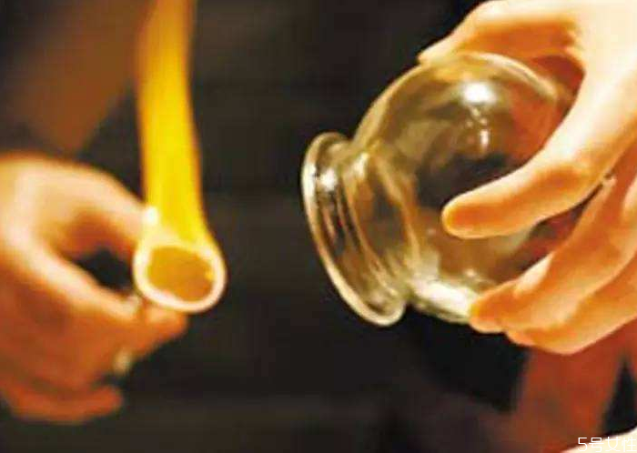 甲亢可以拔罐嗎 甲亢可以刮痧頸脖子嗎 甲亢可以拔罐嗎 甲亢可以刮痧頸脖子嗎