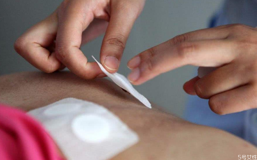 三伏貼為什么貼了感覺涼 三伏貼祛濕效果如何 三伏貼為什么貼了感覺涼 三伏貼祛濕效果如何