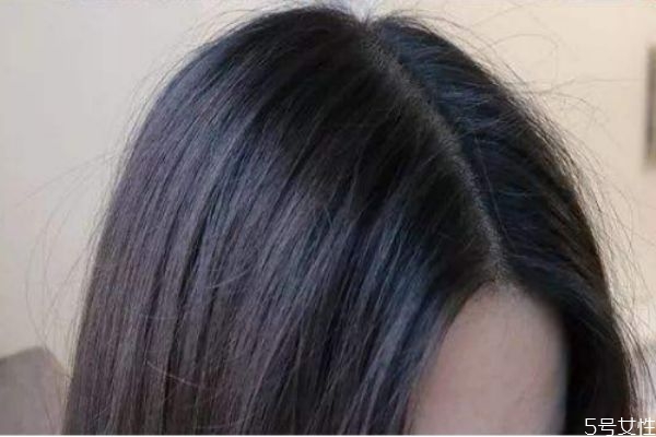 劉海三角區(qū)禿了怎么辦 頭頂劉海處禿了怎么補(bǔ)救 劉海三角區(qū)禿了怎么辦 頭頂劉海處禿了怎么補(bǔ)救