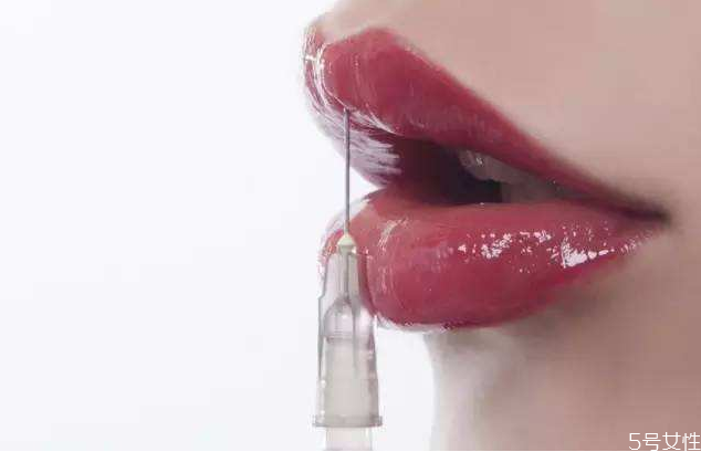 嘴唇打玻尿酸好不好 玻尿酸豐唇幾天最好看 嘴唇打玻尿酸好不好 玻尿酸豐唇幾天最好看