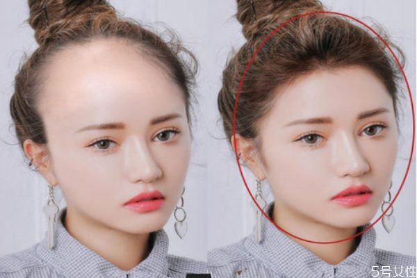 發(fā)際線后移是為什么 發(fā)際線不好看該怎么修飾 發(fā)際線后移是為什么 發(fā)際線不好看該怎么修飾