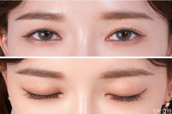 假睫毛會(huì)導(dǎo)致眼皮松嗎 假睫毛貼久了眼皮會(huì)松嗎 假睫毛會(huì)導(dǎo)致眼皮松嗎 假睫毛貼久了眼皮會(huì)松嗎