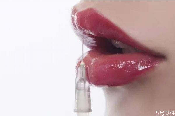 打完嘟嘟唇的禁忌 打嘟嘟唇后的注意事項(xiàng) 打完嘟嘟唇的禁忌 打嘟嘟唇后的注意事項(xiàng)