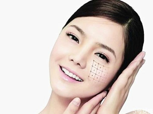 熱瑪吉可以去除雙下巴嗎 熱瑪吉能瘦臉嗎 熱瑪吉可以去除雙下巴嗎 熱瑪吉能瘦臉嗎