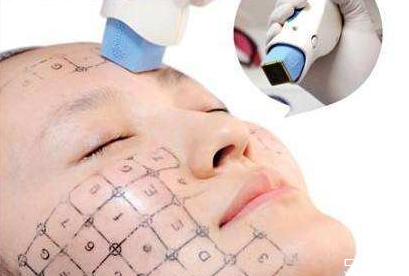 熱瑪吉可以去頸紋嗎 熱瑪吉效果能維持多久 熱瑪吉可以去頸紋嗎 熱瑪吉效果能維持多久