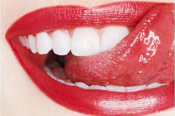 牙齒美白的小竅門有哪些 牙齒美白注意什么 牙齒美白的小竅門有哪些 牙齒美白注意什么