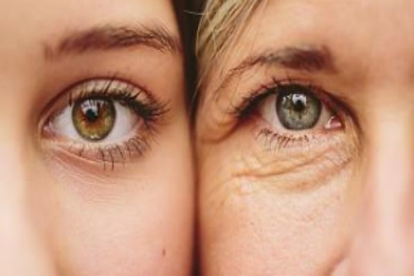 女人臉部顯老的特點 女人臉部顯老的原因 女人臉部顯老的特點 女人臉部顯老的原因