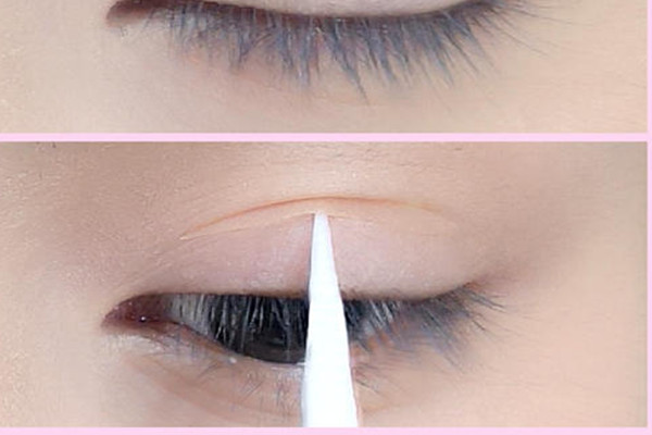 蕾絲雙眼皮貼會(huì)讓眼皮松弛嗎 蕾絲雙眼皮貼會(huì)導(dǎo)致眼皮松弛嗎 蕾絲雙眼皮貼會(huì)讓眼皮松弛嗎 蕾絲雙眼皮貼會(huì)導(dǎo)致眼皮松弛嗎