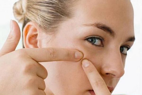 擠痘痘的壞處有什么 為什么不能擠痘痘 擠痘痘的壞處有什么 為什么不能擠痘痘