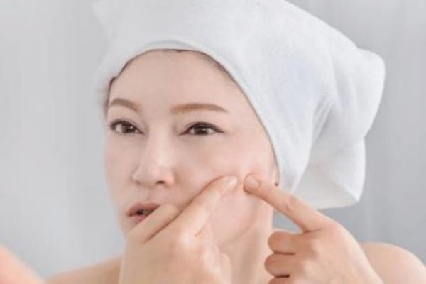 擠痘痘的壞處有什么 為什么不能擠痘痘 擠痘痘的壞處有什么 為什么不能擠痘痘