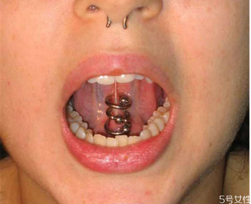 舌釘發(fā)炎了怎么辦 舌釘怎么護(hù)理 舌釘發(fā)炎了怎么辦 舌釘怎么護(hù)理
