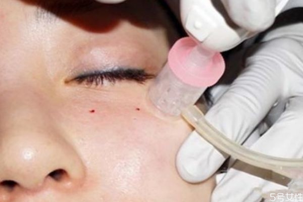 做水光24小時(shí)后化妝了可以嗎 水光針品牌都有哪些 做水光24小時(shí)后化妝了可以嗎 水光針品牌都有哪些