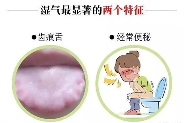 濕氣重的人有哪些癥狀 有這些基本癥狀 濕氣重的人有哪些癥狀 有這些基本癥狀