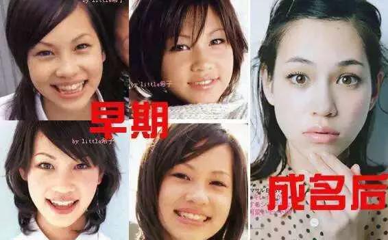 日式整容和韓式整容有什么區(qū)別 極致美與自然美 日式整容和韓式整容有什么區(qū)別 極致美與自然美