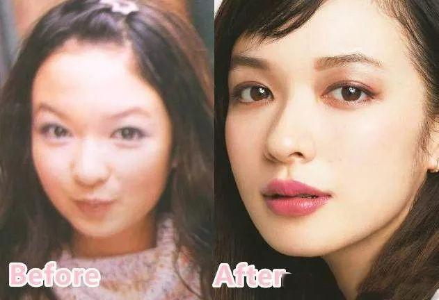 日式整容和韓式整容有什么區(qū)別 極致美與自然美 日式整容和韓式整容有什么區(qū)別 極致美與自然美