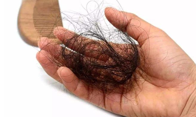 經(jīng)常掉頭發(fā)的人身體是缺什么營(yíng)養(yǎng) 經(jīng)常掉頭發(fā)的人身體是缺什么營(yíng)養(yǎng)