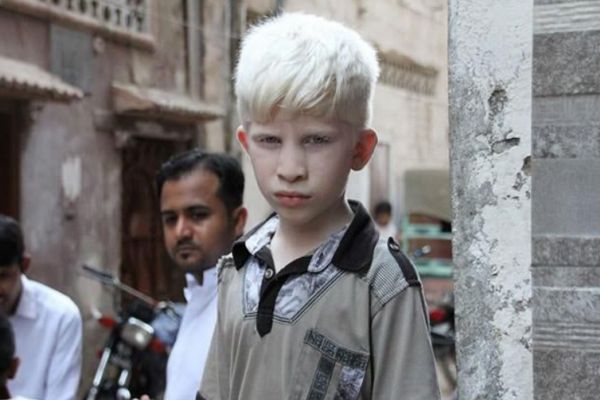 白頭發(fā)與壽命長短有關系嗎 白頭發(fā)影響壽命嗎 白頭發(fā)與壽命長短有關系嗎 白頭發(fā)影響壽命嗎