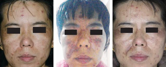 甘醇酸60可以刷臉嗎 在家用甘醇酸刷酸教程 甘醇酸60可以刷臉嗎 在家用甘醇酸刷酸教程