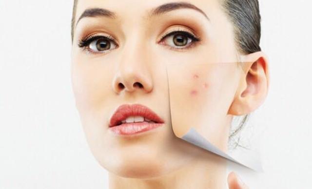 過度護膚的表現(xiàn) 過度護膚后怎么修復(fù) 過度護膚的表現(xiàn) 過度護膚后怎么修復(fù)