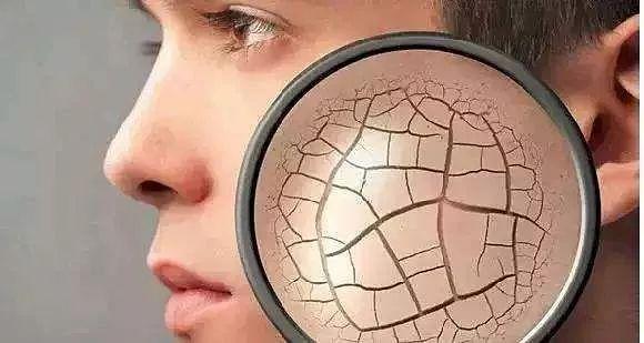 肌膚如何保濕補(bǔ)水 干燥肌膚如何保濕 肌膚如何保濕補(bǔ)水 干燥肌膚如何保濕