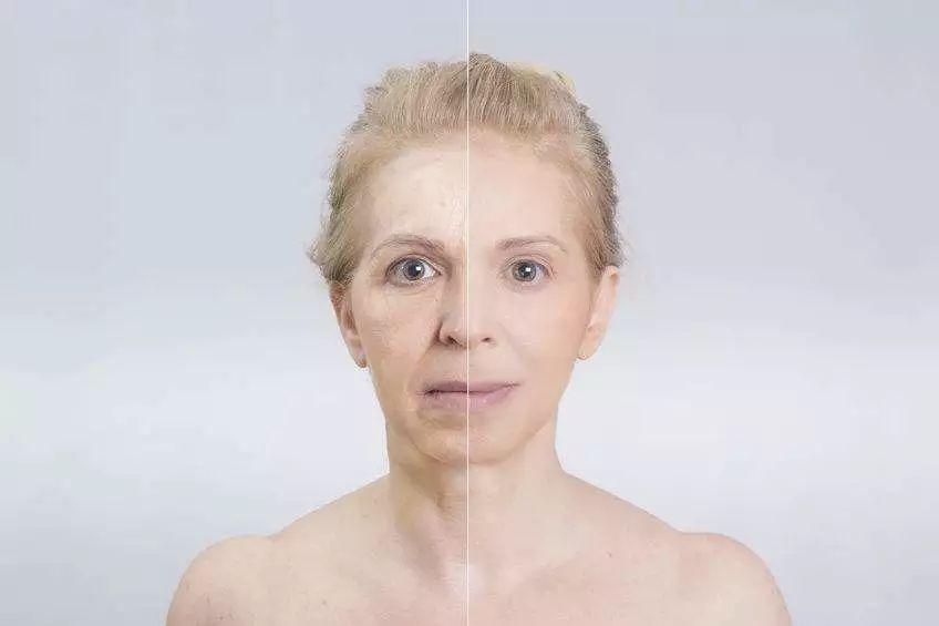 抗皺紋的方法 抗皺紋的食物有哪些 抗皺紋的方法 抗皺紋的食物有哪些