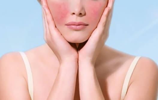 敏感肌臉頰泛紅怎么修復(fù) 敏感肌怎么修復(fù)成正常肌膚 敏感肌臉頰泛紅怎么修復(fù) 敏感肌怎么修復(fù)成正常肌膚