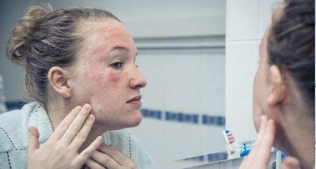 敏感肌臉頰泛紅怎么修復(fù) 敏感肌怎么修復(fù)成正常肌膚 敏感肌臉頰泛紅怎么修復(fù) 敏感肌怎么修復(fù)成正常肌膚