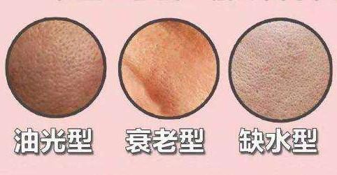 解決毛孔粗大最有效的方法 毛孔粗大怎么修復(fù) 解決毛孔粗大最有效的方法 毛孔粗大怎么修復(fù)